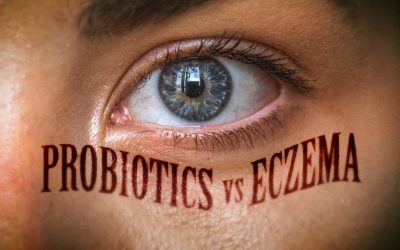 Probiotics Vs Eczema