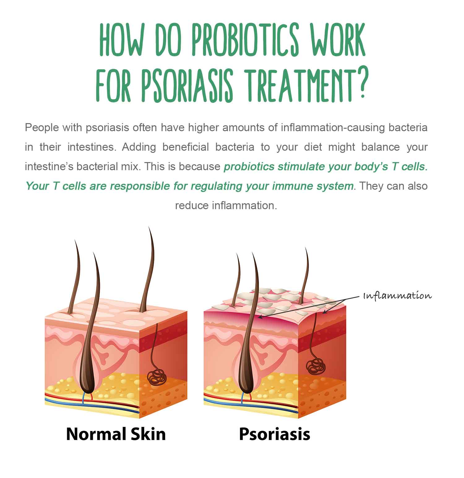 OM-X good for Psoriasis